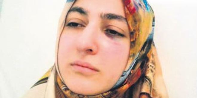 'Dişimi acıttın' dedi diş hekimini yumrukladı