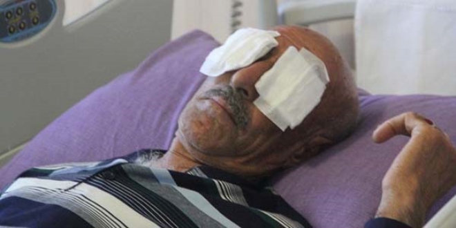 Tartıştığı uyuşturucu bağımlısı, parmakla 2 gözünü oydu