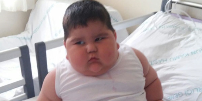 1,5 yaşındaki Yağız bebek 36 kiloya ulaştı