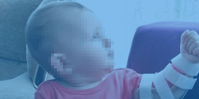 Hastanede 1 bebek �ld�, 7'si sakat kald�