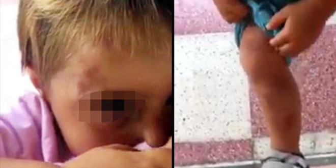 Oğluna şiddet uyguladığı iddia edilen babaya gözaltı