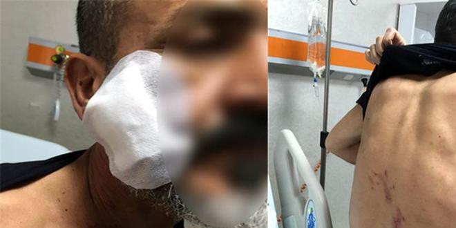 4 polise 'işadamına işkenceden' dava