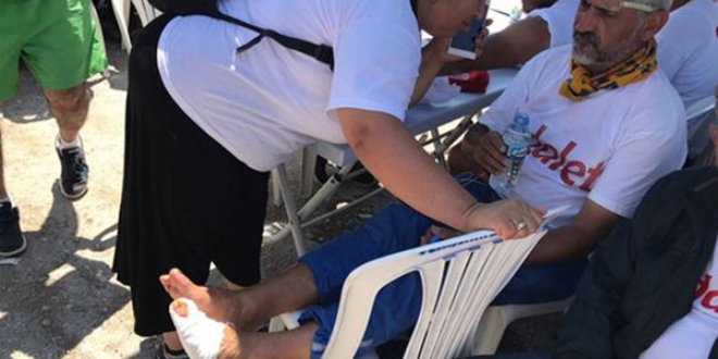 CHP'li vekilin ayaklar� y�r�y���n ard�ndan bu hale geldi