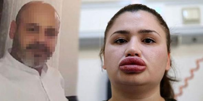 'Sahte estetikçi' kuaförün tahliye edilmesine itiraz