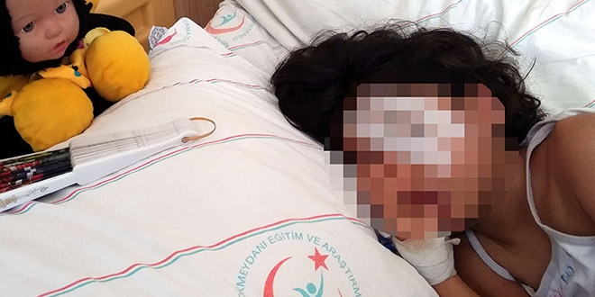 Magandalar yüzünden gözünü kaybedebilir