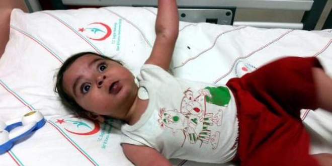 Kalp hastas� Mira� bebek yo�un bak�ma kald�r�ld�