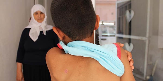 S�rt�nda 'maganda kur�unuyla' ya��yor