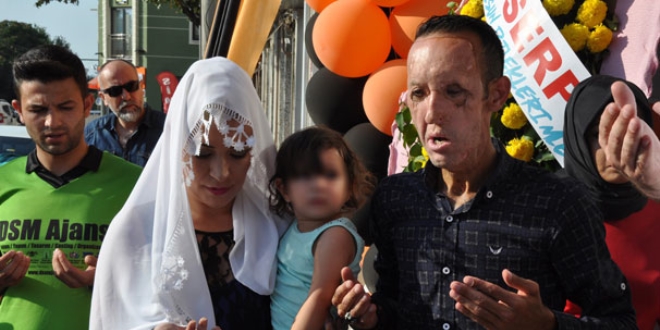 Yüz nakilli Recep Sert, borcunu ödemeyince tutuklandı