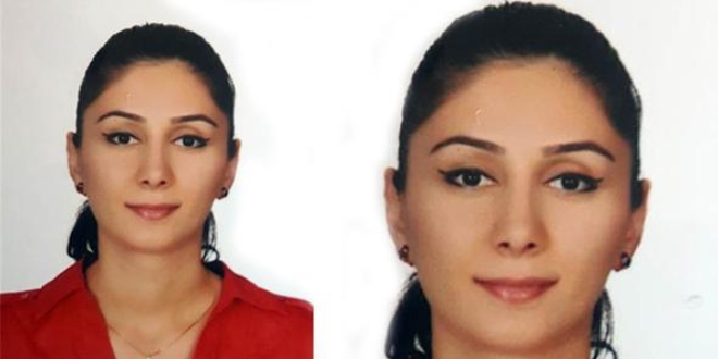 Estetik ameliyata girdi, kalbi durdu