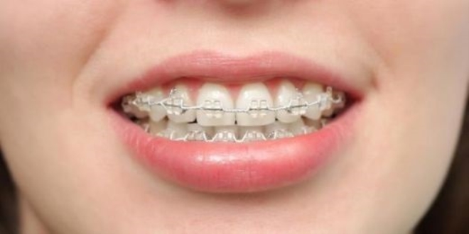 Her yata ortodontik tedavi yaplmas mmkn