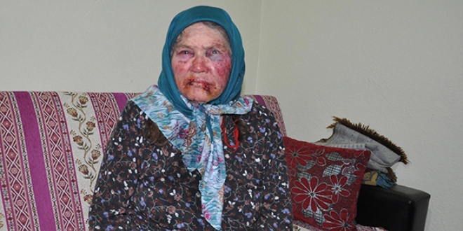 Darp edilen 75 yaşındaki kadının torunu gözaltında