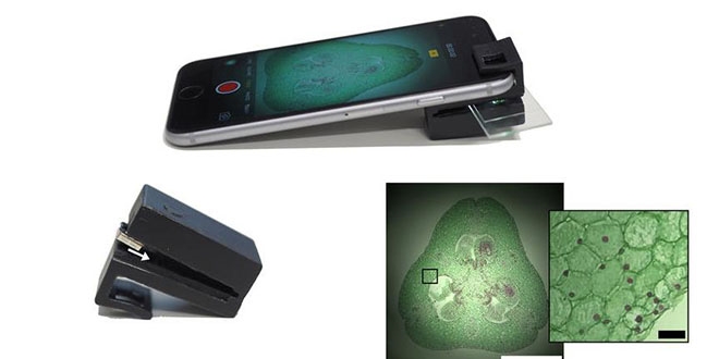 Optik eklenti cep telefonunu mikroskoba dntryor