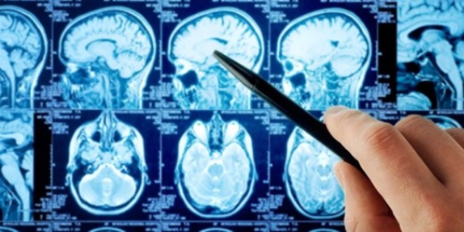 Beyin hasarlar� ambulansta tespit edilebilecek