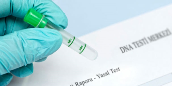 Babalık testi yaptıranların sayısında büyük artış