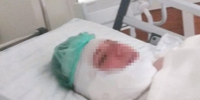 DEAŞ için Suriye'ye gitmedi diye kocasından şiddet gören kadın