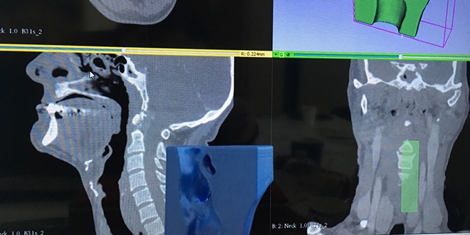 SD�'den sa�l�k alan�nda yenilik�i �al��ma