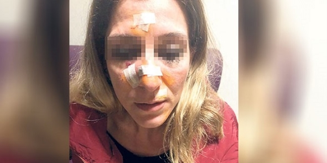 Koruma kararının bitmesini bekledi sonra bıçakla öldürmeye çalıştı