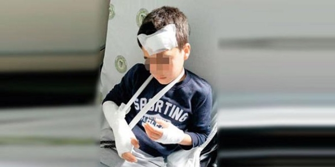 Aşırı yüklü servisten yola düşen öğrenci yaralandı