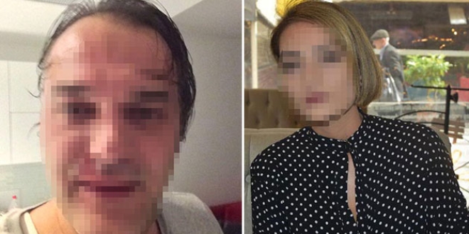Öğretim görevlisi'ne dayak soruşturması