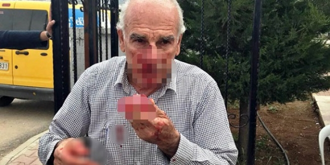 İki kardeş, müdür yardımcısının burnunu kırdı