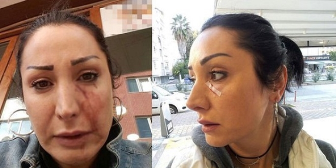 'Patatesi değiştir' dedi, garson bıçağı yüzüne fırlattı