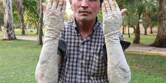 B�yle isyan etti: Beni g�ren korkup ka��yor