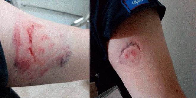 Doktora sataştı, araya giren memurun kolunu ısırdı