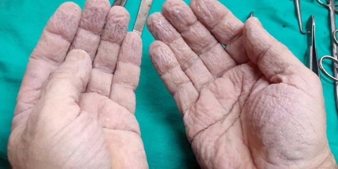Cerrahın elleri sosyal medyayı salladı