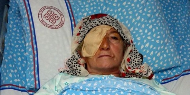 Erzurum'da katarakt ameliyatı sonrası enfeksiyon iddiası