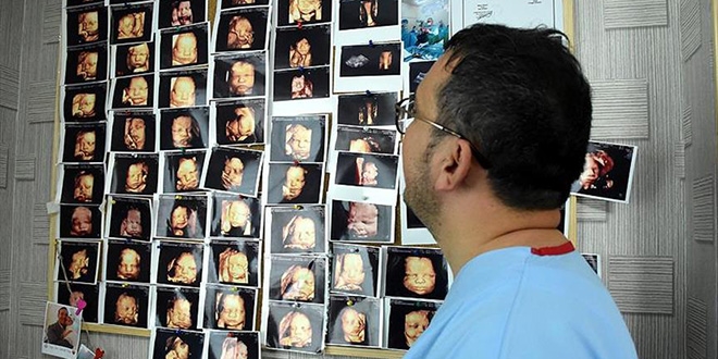 Ultrason fotoğraflarından koleksiyon yaptı