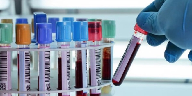 Kanada'da bilim insanlar, kan dntren teknik gelitirdi