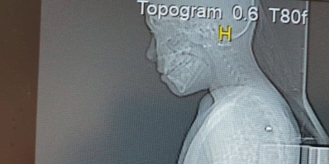 Parkta �ocuk vuran ��pheli serbest