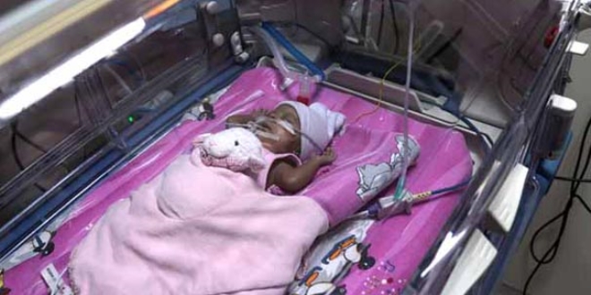 565 gram doğan Şenay bebek yaşama tutundu