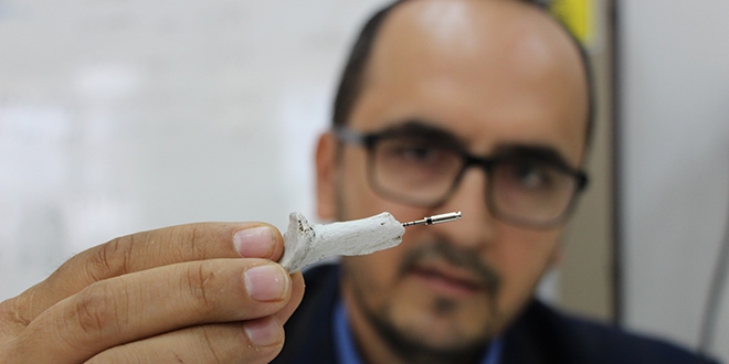 İmplant dünyasında çığır açacak gelişme