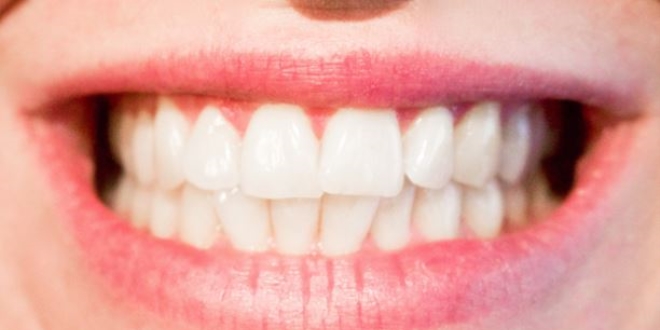 'Di�etindeki renklenmeler hastal�k belirtisi olabilir'