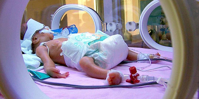 'Türkiye'de her 10 bebekten biri hayata erken başlıyor'