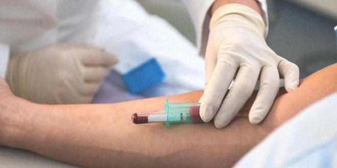 Ge�en y�l d�nyada 36 milyon ki�i HIV vir�s�ne yakaland�