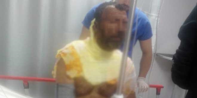 Antalya'da inan�lmaz olay! E�ine k�z�p kendini yakt�