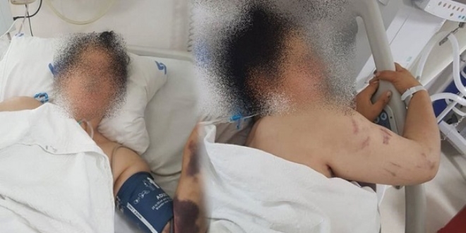 Hamile eşini pompalı tüfekle vurdu