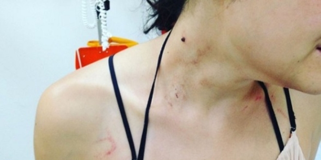 M�zisyene darp iddias�na dava