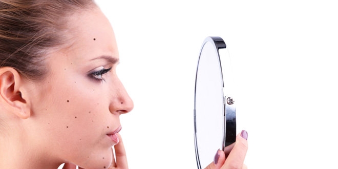 K�t� huylu benlerde lazer kullan�m�na dikkat