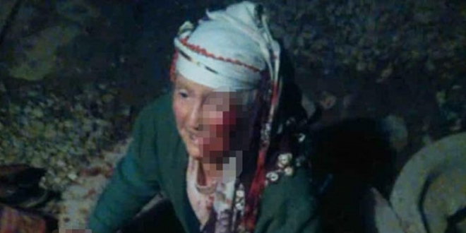 Üstü açık bırakılan rögara düşen yaşlı kadın yaralandı