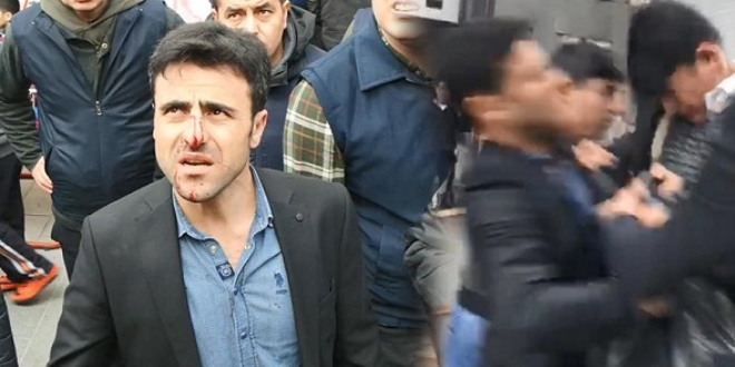 Seyyar satıcı, zabıta komiserinin burnunu kırdı