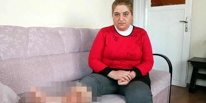 Sivilceyi nemsemedi, hayat karard