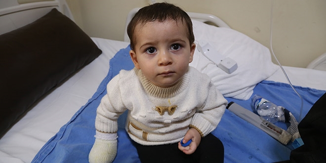 Kaynar sütle yanan çocuk tedavi altına alındı