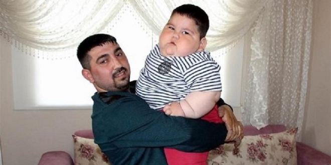 Yağız bebek 55 kiloya ulaştı