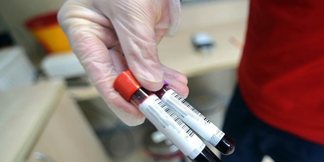 Kanserle mcadelenin yeni silah: kan testleri