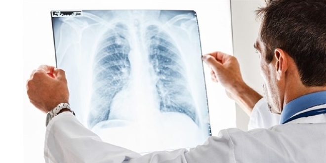 Earbn balamak iin azna ald toplu ine akcierine kat