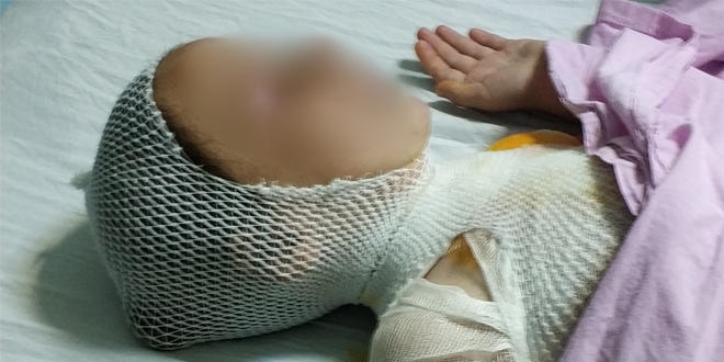 Kaynatılırken taşan süt çocuğu hastanelik etti
