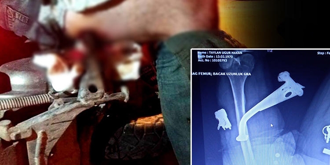 Doktorlar bile ok oldu... Hastaneye bu halde getirildi